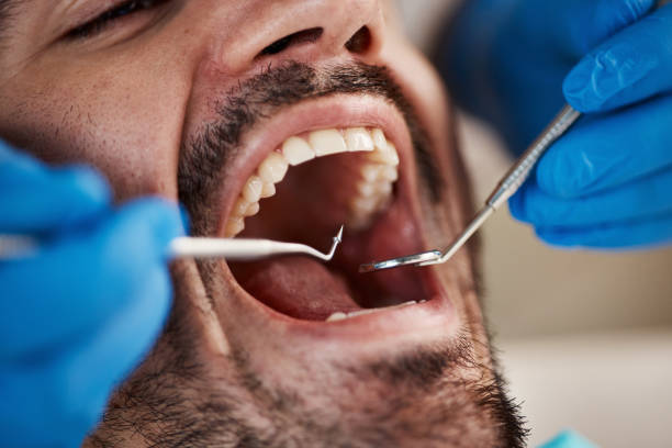 Best Emergency Dental Extractions in Texas City, TX
